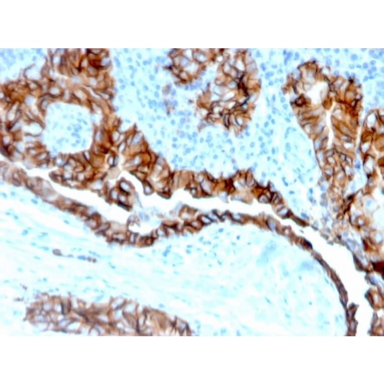 Immunohistochemistry - Anti-TROP2 Antibody [TACSTD2/6394R] (A278023) - Antibodies.com