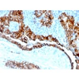 Immunohistochemistry - Anti-TROP2 Antibody [TACSTD2/6394R] (A278023) - Antibodies.com