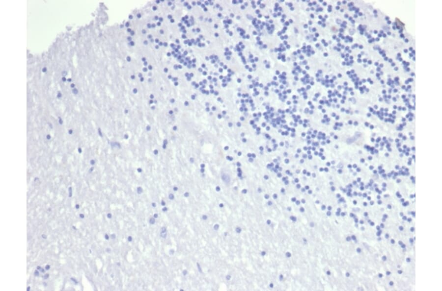 Immunohistochemistry - Anti-TROP2 Antibody [TACSTD2/6394R] (A278023) - Antibodies.com