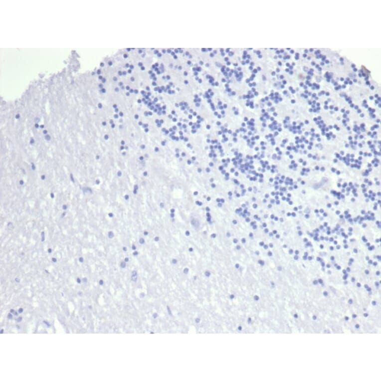 Immunohistochemistry - Anti-TROP2 Antibody [TACSTD2/6394R] (A278023) - Antibodies.com