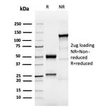SDS-PAGE - Anti-TROP2 Antibody [TACSTD2/6394R] (A278023) - Antibodies.com