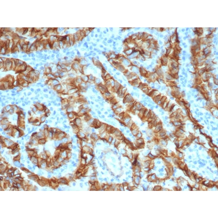 Immunohistochemistry - Anti-TROP2 Antibody [TACSTD2/6396R] (A278024) - Antibodies.com