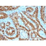 Immunohistochemistry - Anti-TROP2 Antibody [TACSTD2/6396R] (A278024) - Antibodies.com