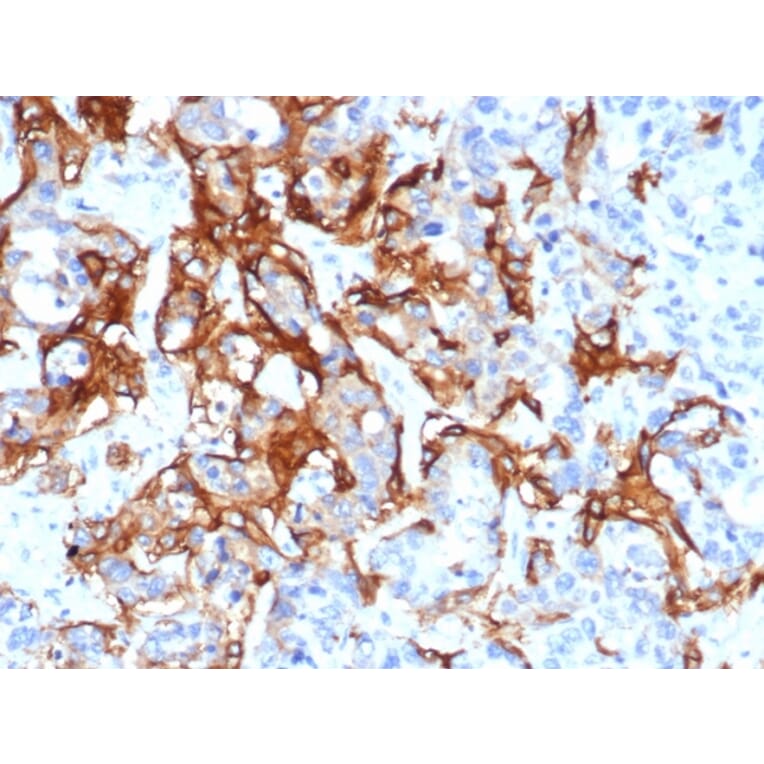 Immunohistochemistry - Anti-TROP2 Antibody [TACSTD2/6396R] (A278024) - Antibodies.com