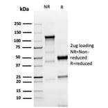 SDS-PAGE - Anti-TROP2 Antibody [TACSTD2/6396R] (A278024) - Antibodies.com