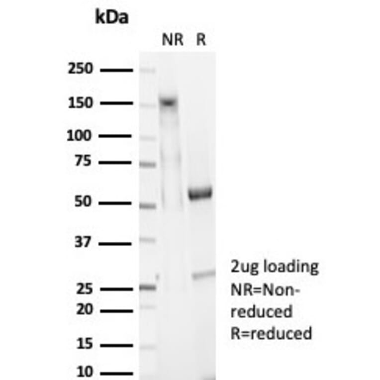 SDS-PAGE - Anti-EpCAM Antibody [EGP40/7025R] (A278025) - Antibodies.com