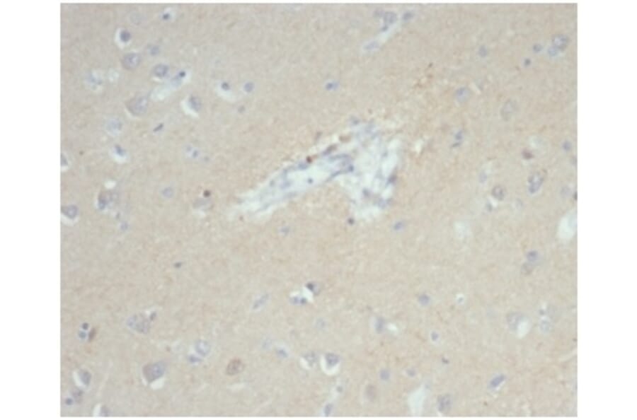 Immunohistochemistry - Anti-EpCAM Antibody [EGP40/7035R] (A278026) - Antibodies.com