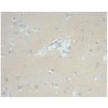 Immunohistochemistry - Anti-EpCAM Antibody [EGP40/7035R] (A278026) - Antibodies.com