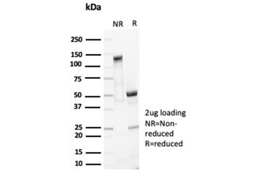 SDS-PAGE - Anti-EpCAM Antibody [EGP40/7035R] (A278026) - Antibodies.com