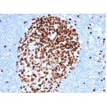 Immunohistochemistry - Anti-Ki67 Antibody [MKI67/4947R] (A278028) - Antibodies.com