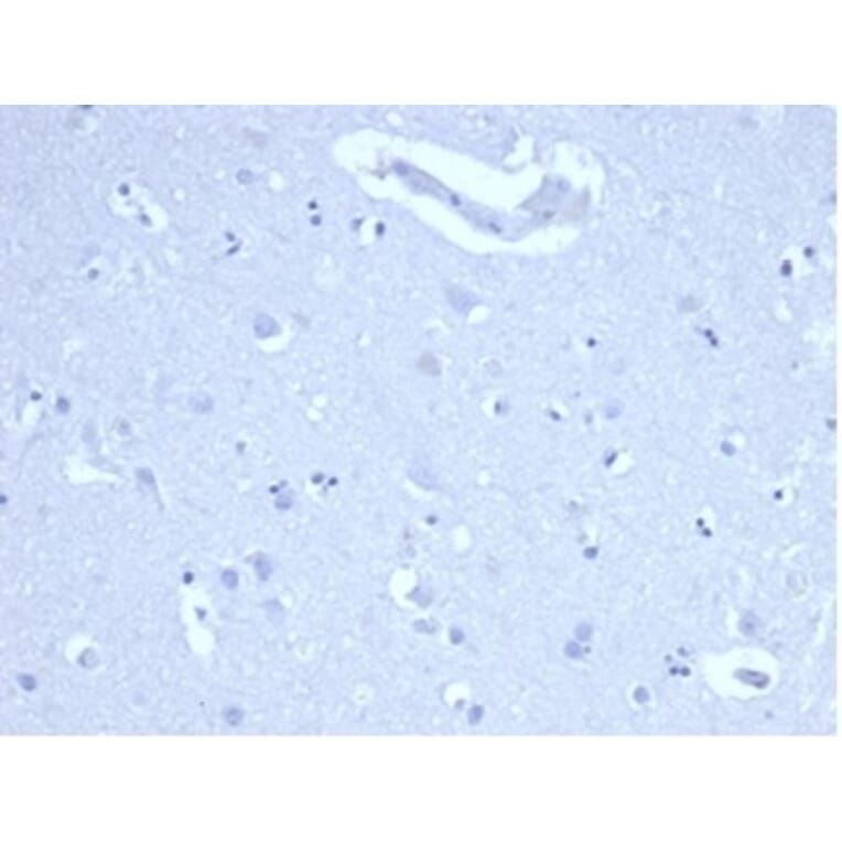 Immunohistochemistry - Anti-Ki67 Antibody [MKI67/4947R] (A278028) - Antibodies.com