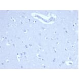 Immunohistochemistry - Anti-Ki67 Antibody [MKI67/4947R] (A278028) - Antibodies.com