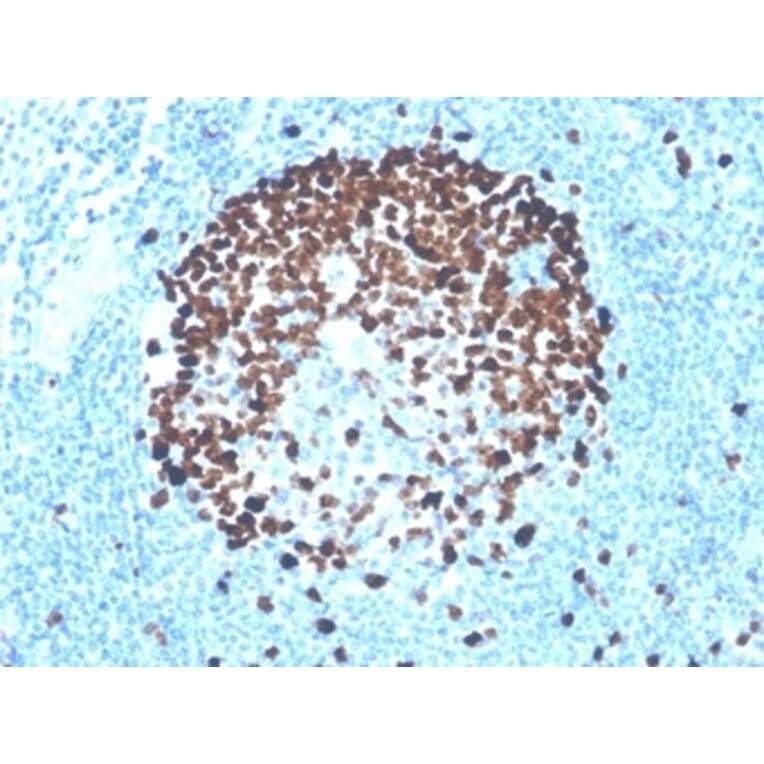 Immunohistochemistry - Anti-Ki67 Antibody [MKI67/4947R] (A278028) - Antibodies.com