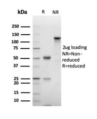 アレルギー 薬の副作用である薬剤性偽アレルギーをP2X4受容体が促進している
