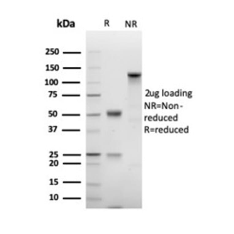 SDS-PAGE - Anti-Ki67 Antibody [MKI67/4947R] (A278028) - Antibodies.com