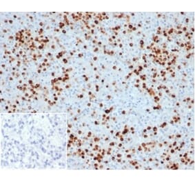 Immunohistochemistry - Anti-Myeloperoxidase Antibody [MPO/33R] (A278030) - Antibodies.com