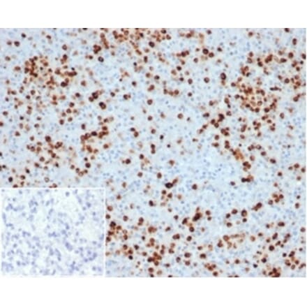 Immunohistochemistry - Anti-Myeloperoxidase Antibody [MPO/33R] (A278030) - Antibodies.com