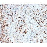 Immunohistochemistry - Anti-Myeloperoxidase Antibody [MPO/33R] (A278030) - Antibodies.com