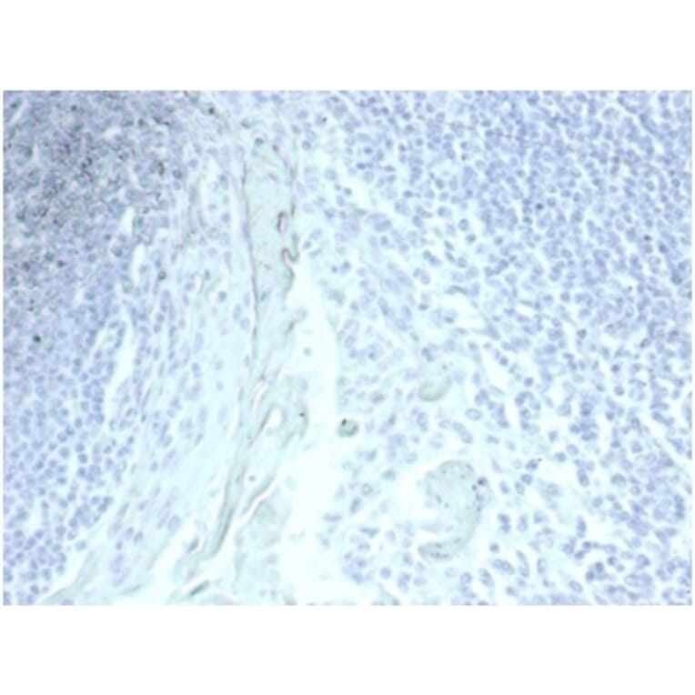 Immunohistochemistry - Anti-Mucin 5AC Antibody [MUC5AC/7067R] (A278032) - Antibodies.com