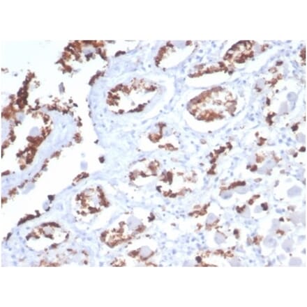 Immunohistochemistry - Anti-Mucin 5AC Antibody [MUC5AC/7068R] (A278033) - Antibodies.com