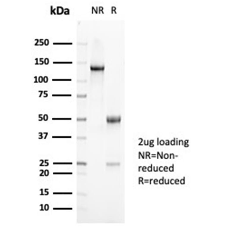 SDS-PAGE - Anti-Mucin 5AC Antibody [MUC5AC/7068R] (A278033) - Antibodies.com