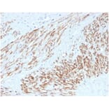 Immunohistochemistry - Anti-MYH11 Antibody [MYH11/4337R] (A278034) - Antibodies.com
