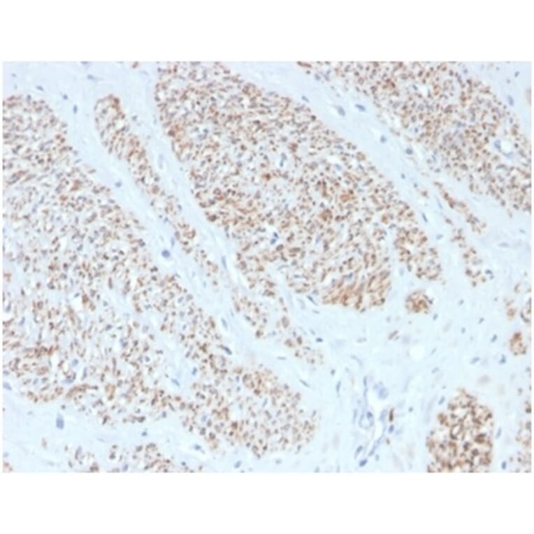 Immunohistochemistry - Anti-MYH11 Antibody [MYH11/4337R] (A278034) - Antibodies.com