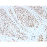 Immunohistochemistry - Anti-MYH11 Antibody [MYH11/4337R] (A278034) - Antibodies.com