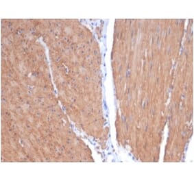 Immunohistochemistry - Anti-MYH11 Antibody [MYH11/7087R] (A278035) - Antibodies.com