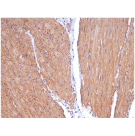 Immunohistochemistry - Anti-MYH11 Antibody [MYH11/7087R] (A278035) - Antibodies.com