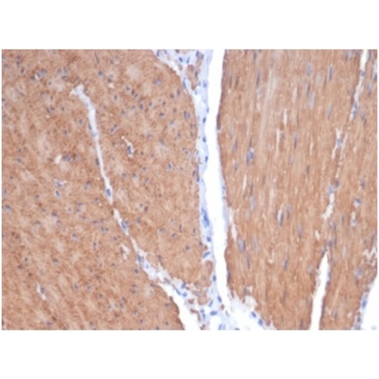 Immunohistochemistry - Anti-MYH11 Antibody [MYH11/7087R] (A278035) - Antibodies.com