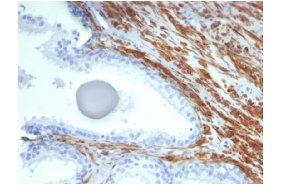 Immunohistochemistry - Anti-MYH11 Antibody [MYH11/7087R] (A278035) - Antibodies.com