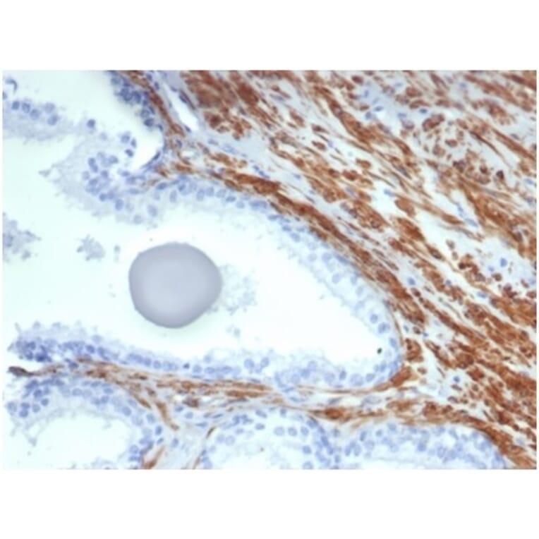 Immunohistochemistry - Anti-MYH11 Antibody [MYH11/7087R] (A278035) - Antibodies.com