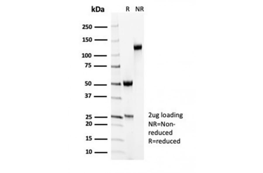 SDS-PAGE - Anti-MYH11 Antibody [MYH11/7087R] (A278035) - Antibodies.com