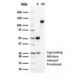 SDS-PAGE - Anti-MYH11 Antibody [MYH11/7087R] (A278035) - Antibodies.com