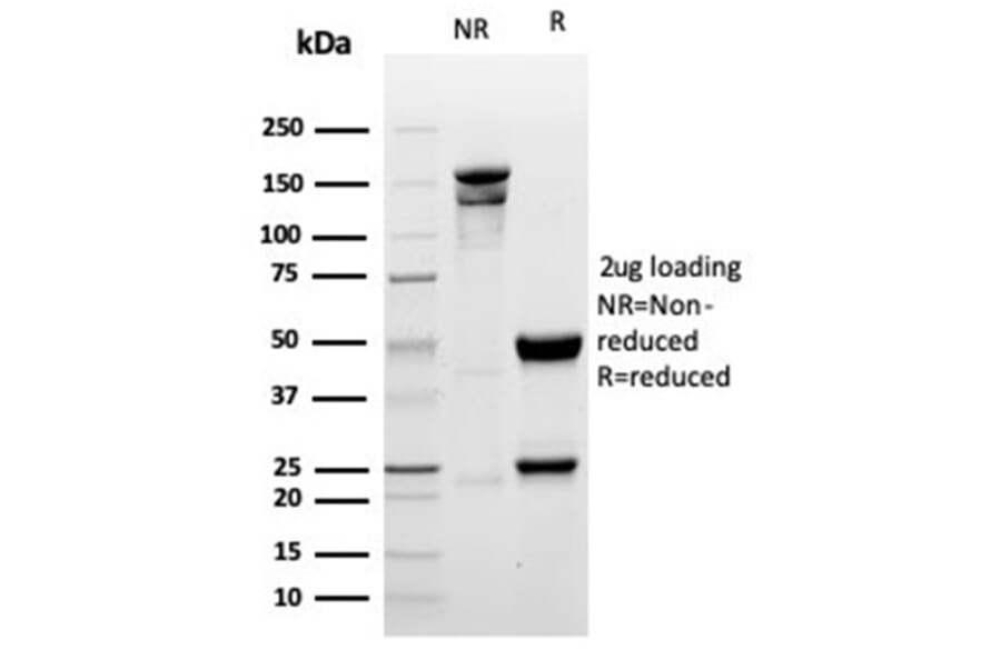 SDS-PAGE - Anti-Myogenin Antibody [MYOG/6298R] (A278036) - Antibodies.com