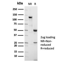 SDS-PAGE - Anti-Nucleolin Antibody [NCL/7014R] (A278037) - Antibodies.com