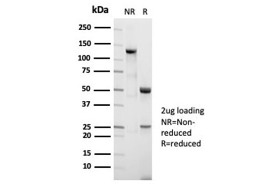 SDS-PAGE - Anti-Nucleolin Antibody [NCL/7014R] (A278037) - Antibodies.com