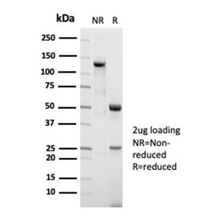 SDS-PAGE - Anti-Nucleolin Antibody [NCL/7014R] (A278037) - Antibodies.com