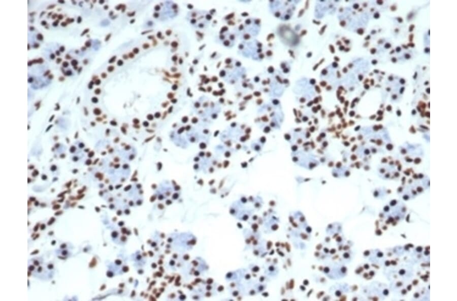 Immunohistochemistry - Anti-Nucleolin Antibody [NCL/7014R] (A278037) - Antibodies.com
