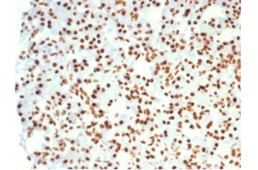 Immunohistochemistry - Anti-Nucleolin Antibody [NCL/7014R] (A278037) - Antibodies.com