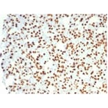 Immunohistochemistry - Anti-Nucleolin Antibody [NCL/7014R] (A278037) - Antibodies.com