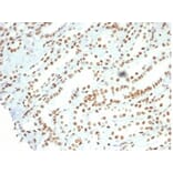 Immunohistochemistry - Anti-Nucleolin Antibody [NCL/7014R] (A278037) - Antibodies.com