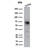 Western Blot - Anti-Nucleolin Antibody [NCL/7014R] (A278037) - Antibodies.com