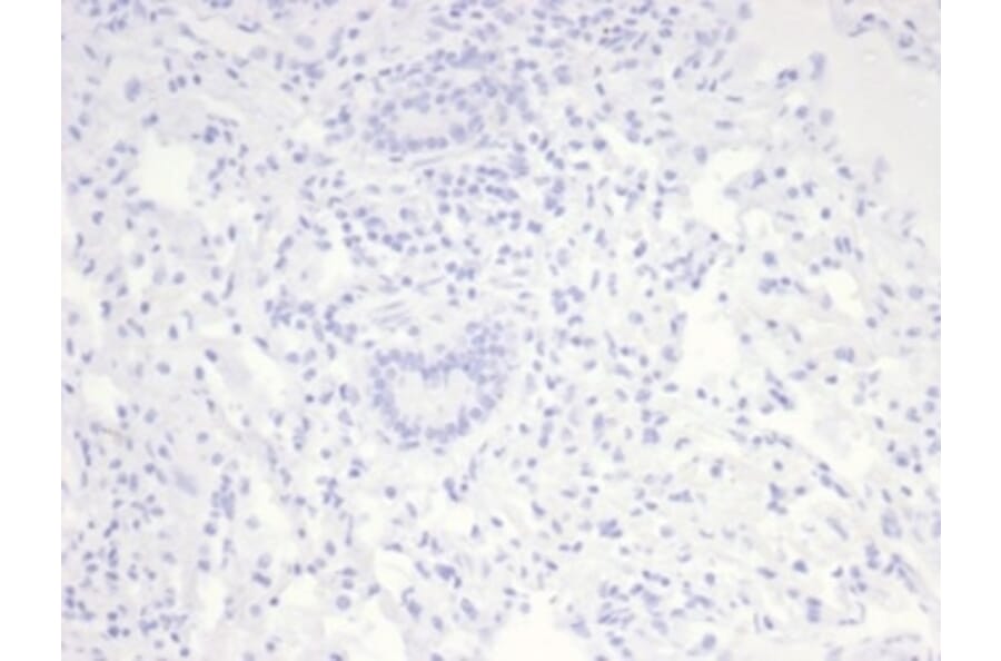 Immunohistochemistry - Anti-Nucleolin Antibody [NCL/7014R] (A278037) - Antibodies.com