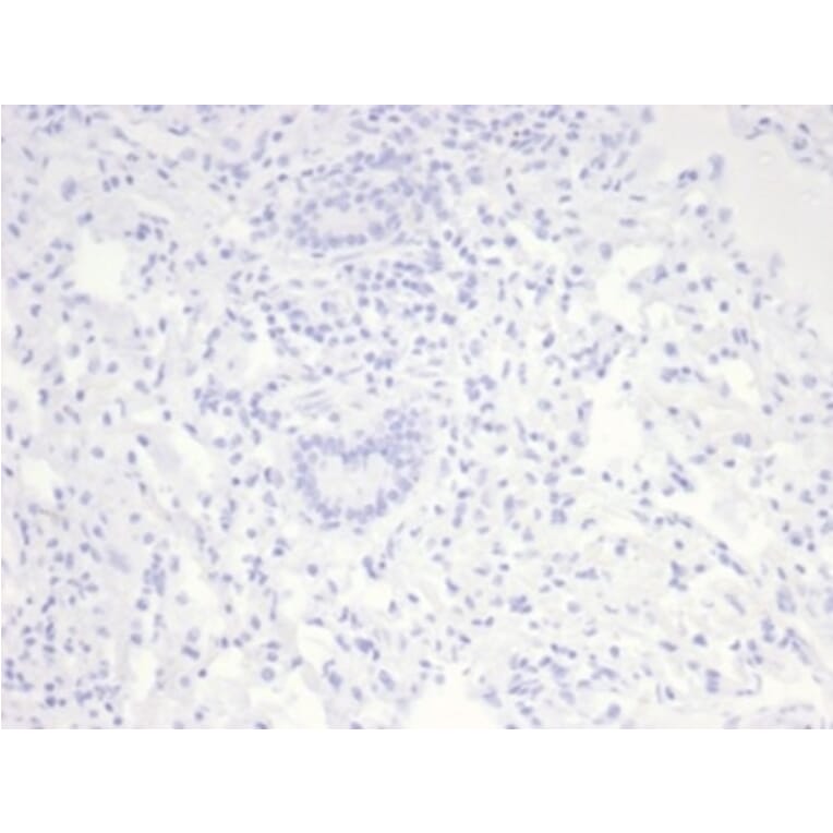 Immunohistochemistry - Anti-Nucleolin Antibody [NCL/7014R] (A278037) - Antibodies.com