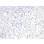 Immunohistochemistry - Anti-Nucleolin Antibody [NCL/7014R] (A278037) - Antibodies.com