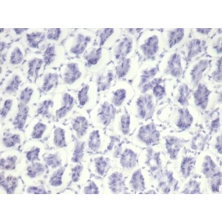 Immunohistochemistry - Anti-Nucleolin Antibody [NCL/7014R] (A278037) - Antibodies.com