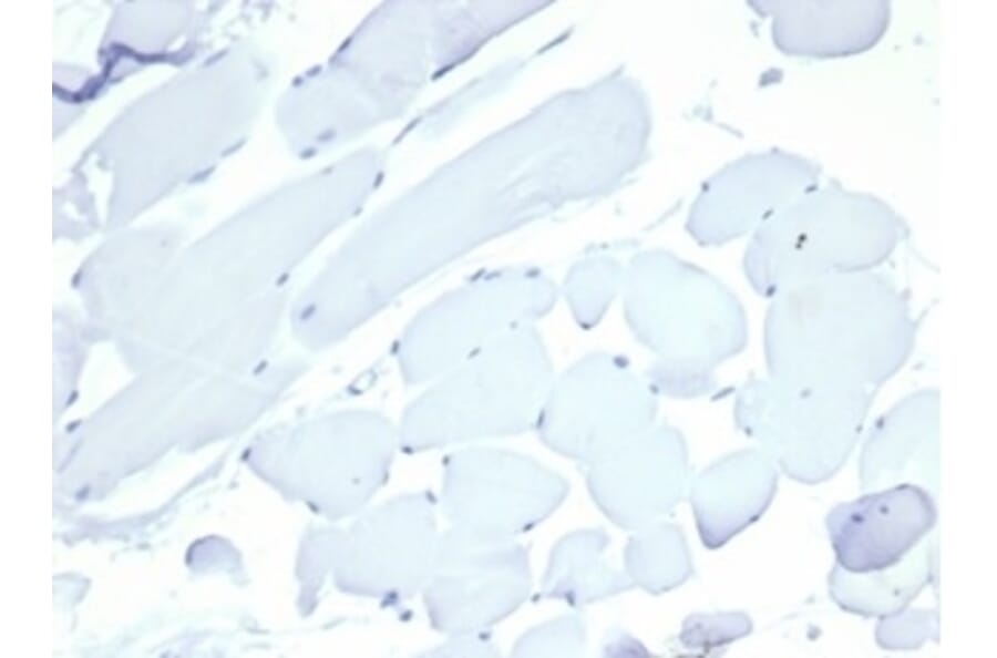 Immunohistochemistry - Anti-Nucleolin Antibody [NCL/7014R] (A278037) - Antibodies.com