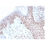 Immunohistochemistry - Anti-Nucleophosmin Antibody [NPM1/7072R] (A278038) - Antibodies.com